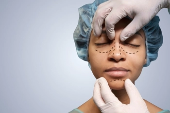 Non Surgical Face Lift