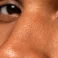 open pores